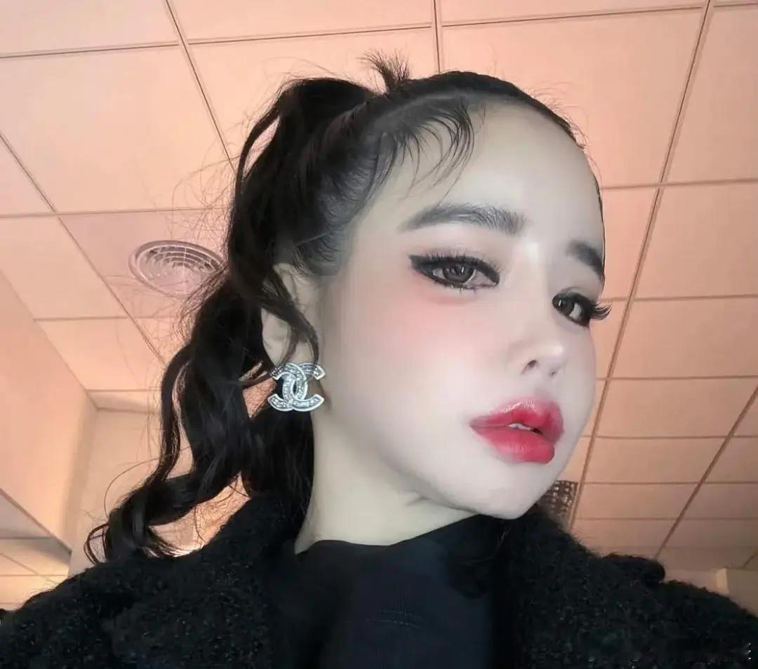 坚持称自己没整容而是激素导致浮肿的朴春​​​