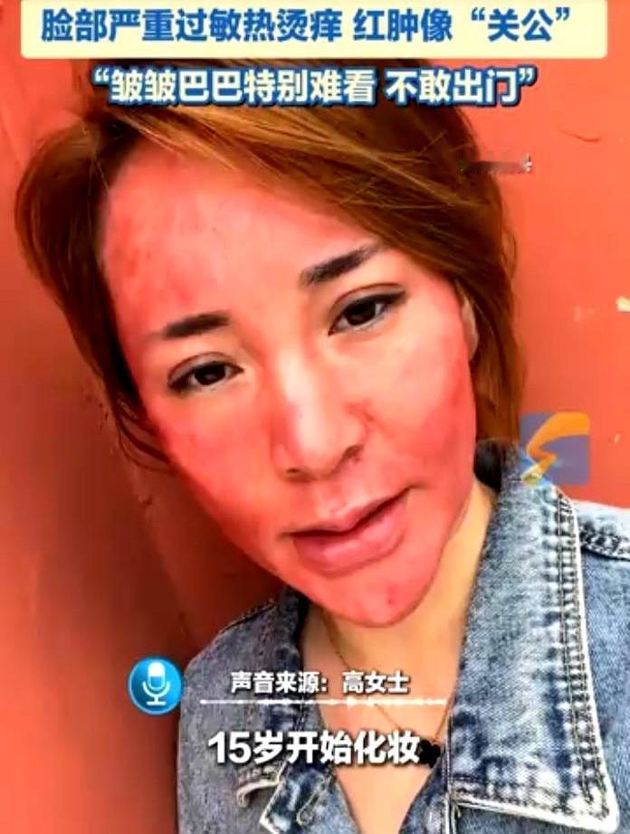 吉林37岁女子从15岁开始化妆，就没有卸过妆。好不容易勤奋一次，心血来潮卸了