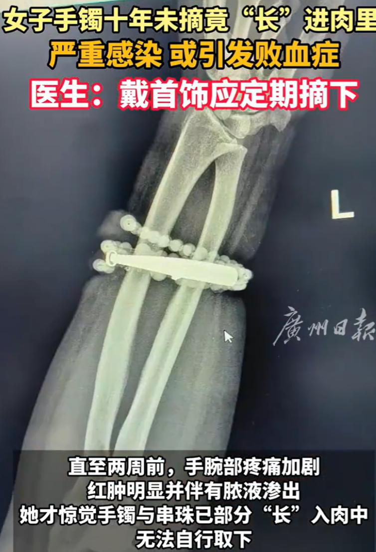 福建宁德，女子发现手腕的位置反复疼痛发痒，开始还以为是皮肤发炎，可随着疼痛加剧，