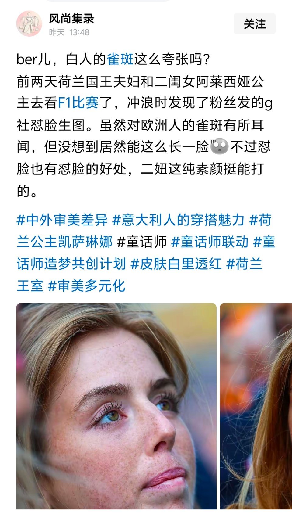 欧美白人没有滤镜的样子，和大家在广告里影视剧里见到的完全不一样​​​