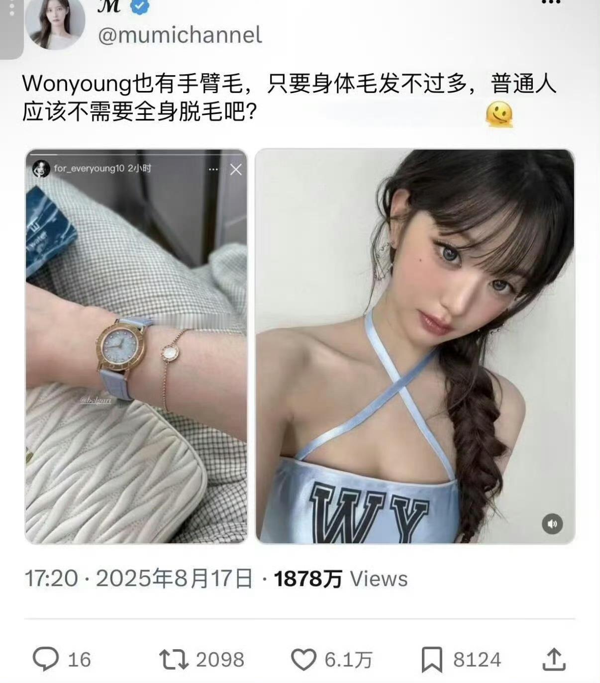 张元英把手臂汗毛P掉了谁懂这种窒息感，天生的手臂汗毛而已，却要承受非议。拍摄图片