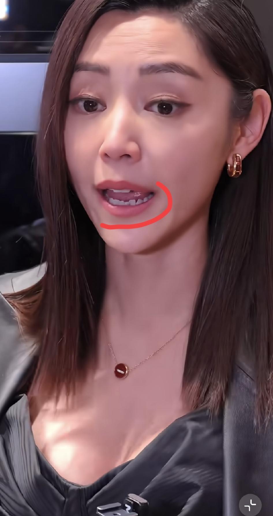 港星真的接地气。你看卫诗雅牙齿，要是在内娱又得被喊去弄烤瓷牙了。因为在内娱，