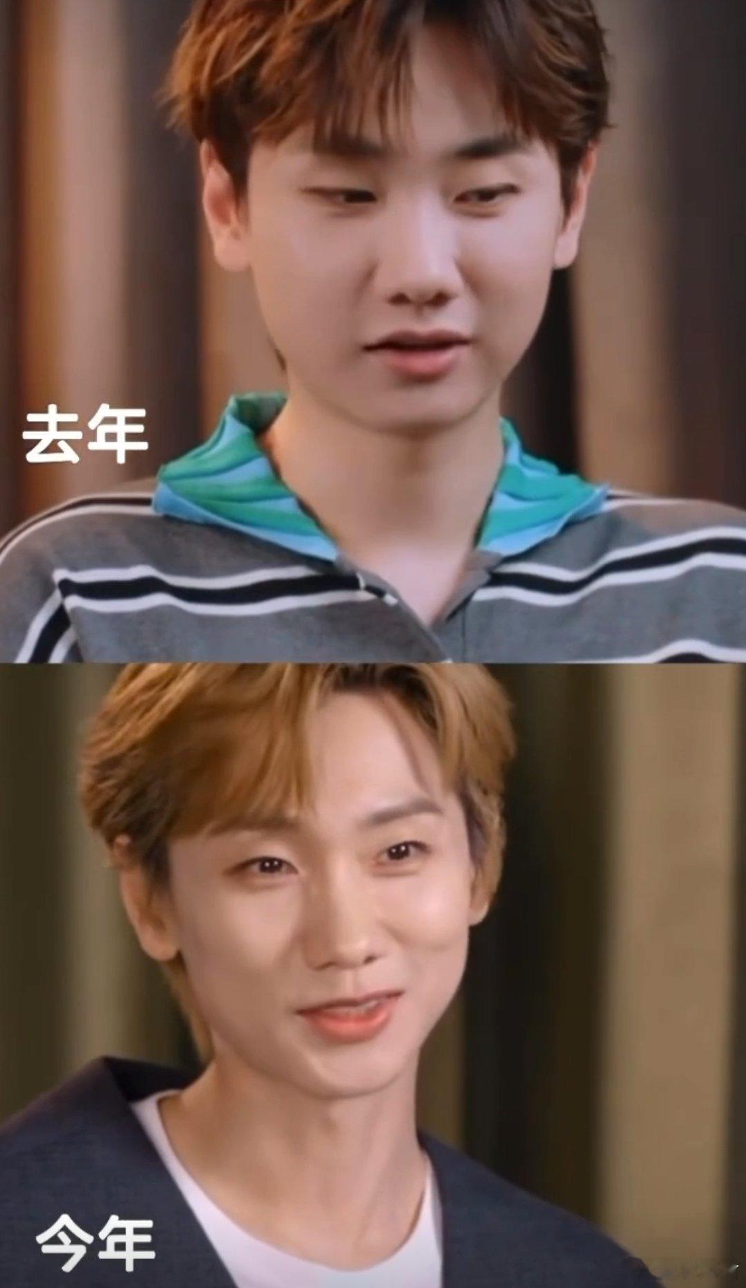 汪苏泷瘦下来之后法令纹都没了。。​​​