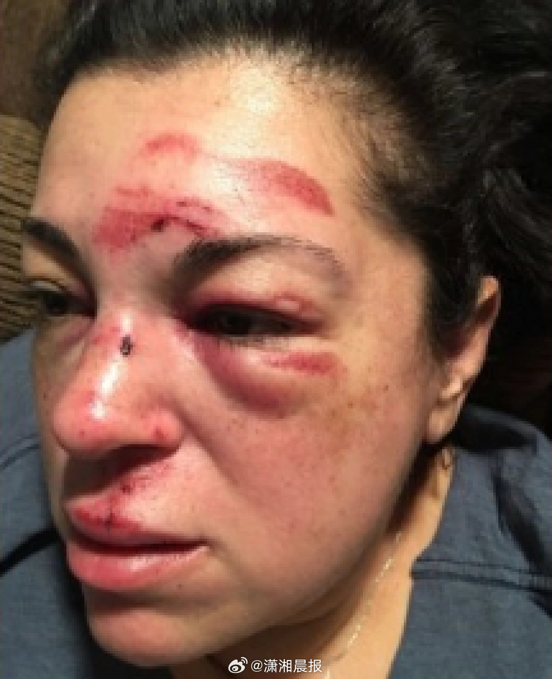 【#女子走路绊倒美市政府赔了750万美元#】#因道路凸起致行人绊倒美国赔偿750