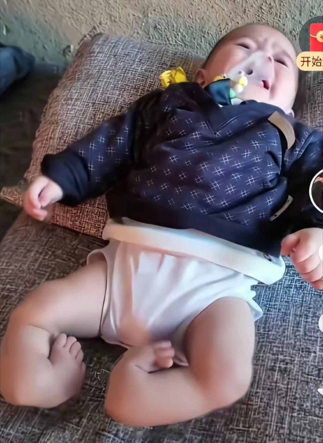 萌娃一出生双脚就严重畸形，像噩梦开了头。也许永远没法正常走路，还是盼着手术能好一