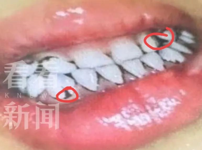 甘肃天水平息幼儿园铅中毒事件努力方向错了目前最大问题就在于幼儿园患者家属对天水