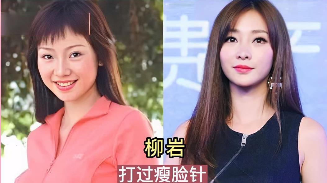 有的演员对整容讳莫如深，即使被外界看出明显变化，也会矢口否认自己整过容。有些演员