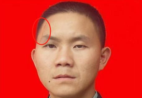 2007年，军人卢加胜正在部队接受领导检查时，领导突然看见他的脸上竟然有一道4厘