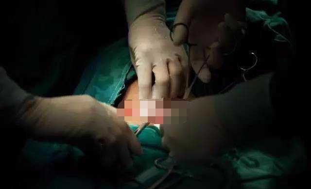 女人生孩子到底顺产好还是剖腹产好, 听听过来孕妈的亲身讲述!