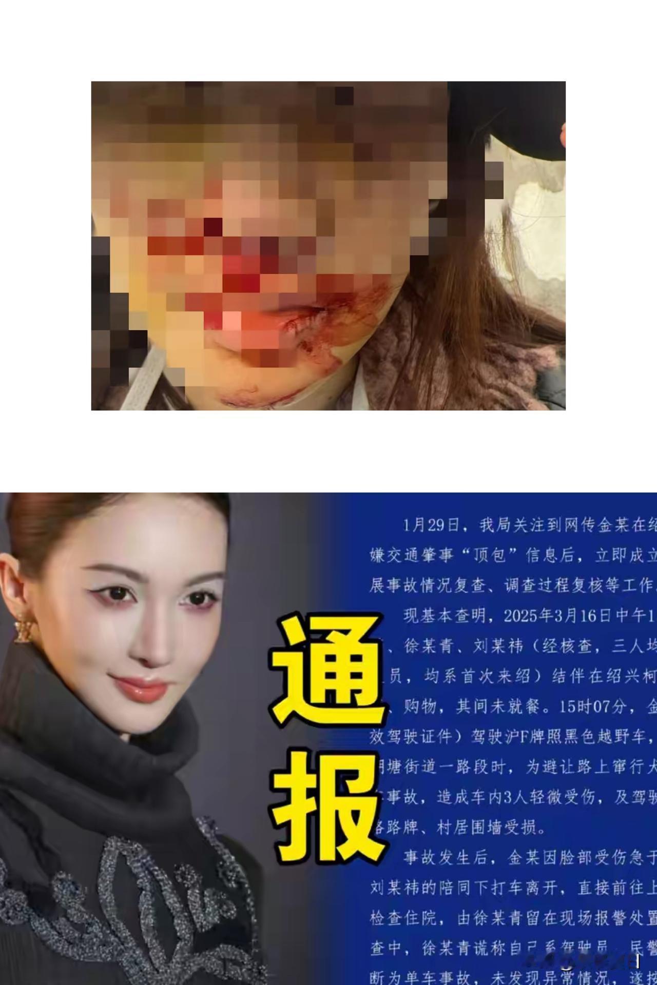 满脸是血还跨省就医？金晨放弃绍兴直奔上海，原来鼻子歪了真不是“随便治治”！