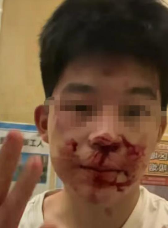 冒充民警打人者拘12天，借高考名义提前释放，22万买受害者闭嘴！民警子女就能肆意