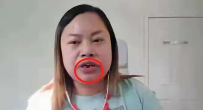 看来美国的斩杀线在凤姐的身上已经展现了，在美国既没有任何人的托举，又没有自己的住