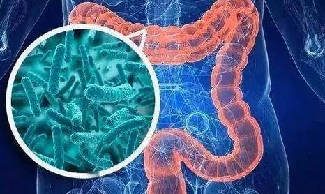 医生调查发现：肠道内有息肉的人，身体一般或可能有这3个特征  肠息肉，健康