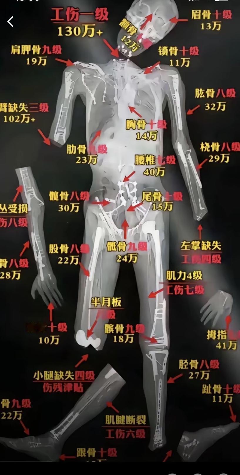 家人们谁懂啊！现在工伤赔偿都出“人体价目表”了，这骨头跟超市标价似的，哪疼哪断一