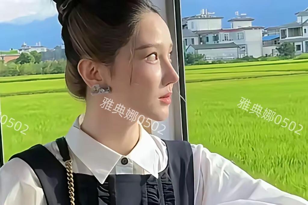 陈小纭是美颜开大了，还是又动脸了？感觉她又跟以前长得不一样了，脸和鼻子都特别尖