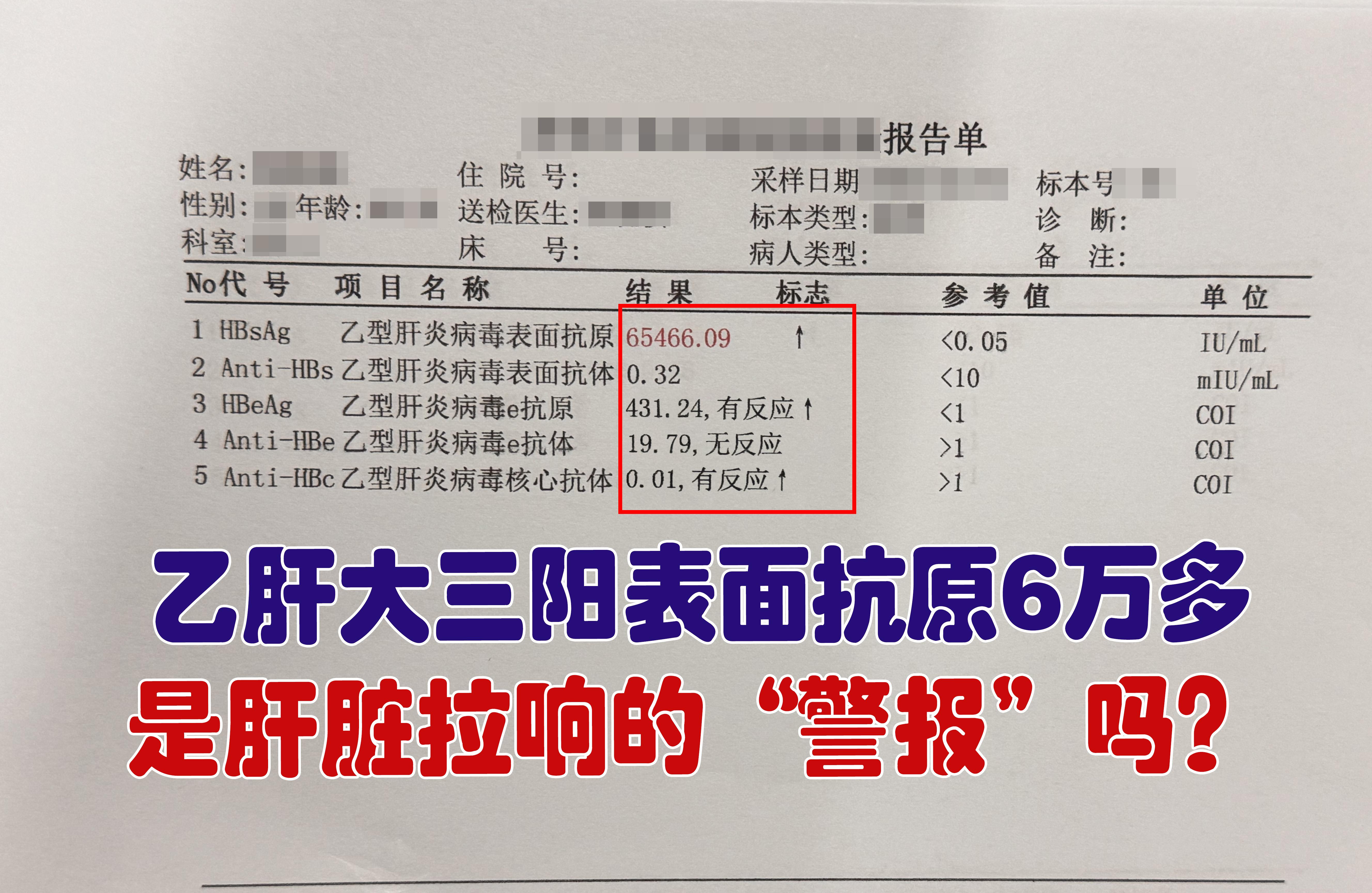 乙肝大三阳表面抗原6万多是肝脏拉响的“警报”吗？  这是昨天接诊了一位...