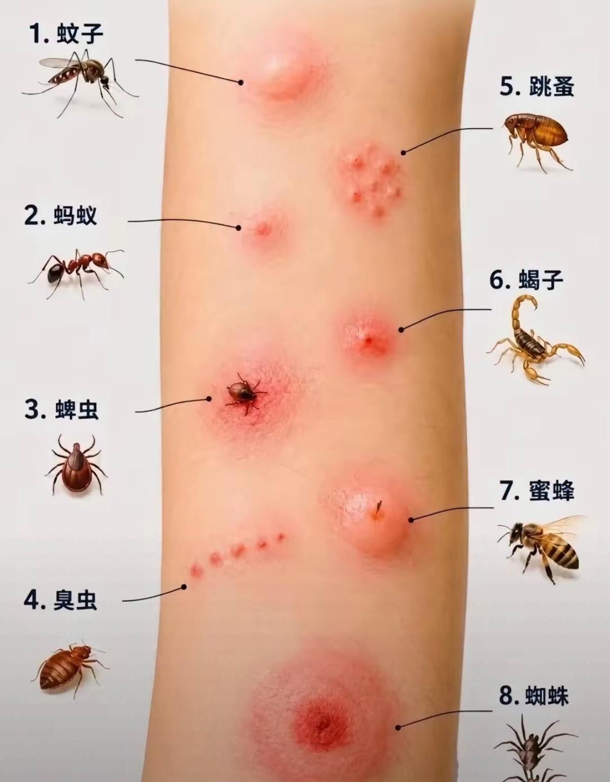 被蚊子、蚂蚁等叮咬后的反应，一目了然。
