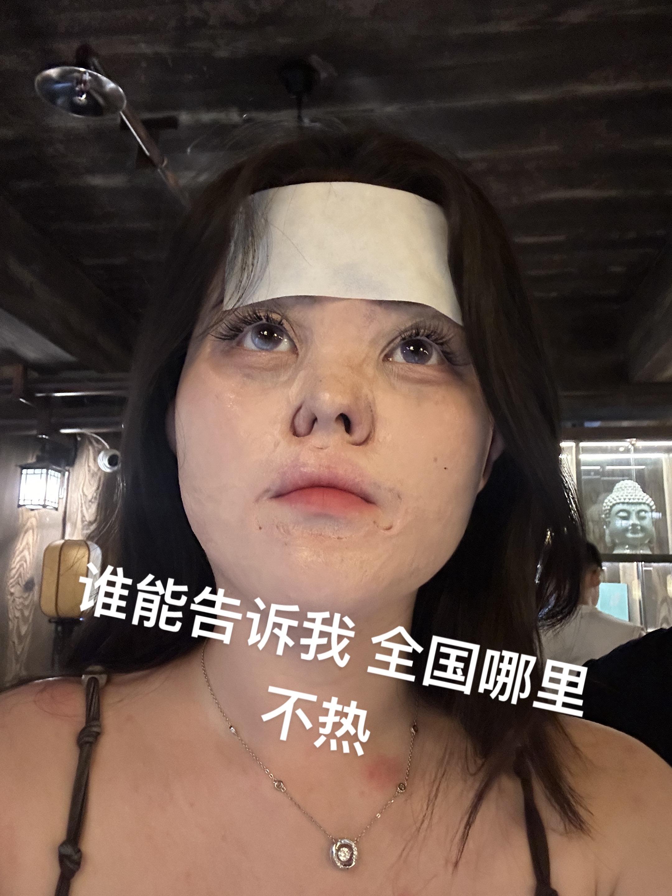 热化了