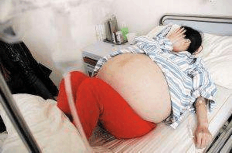 90后“孕妇怀上五胞胎, 孩子们的性别, 成为医院一大喜事!