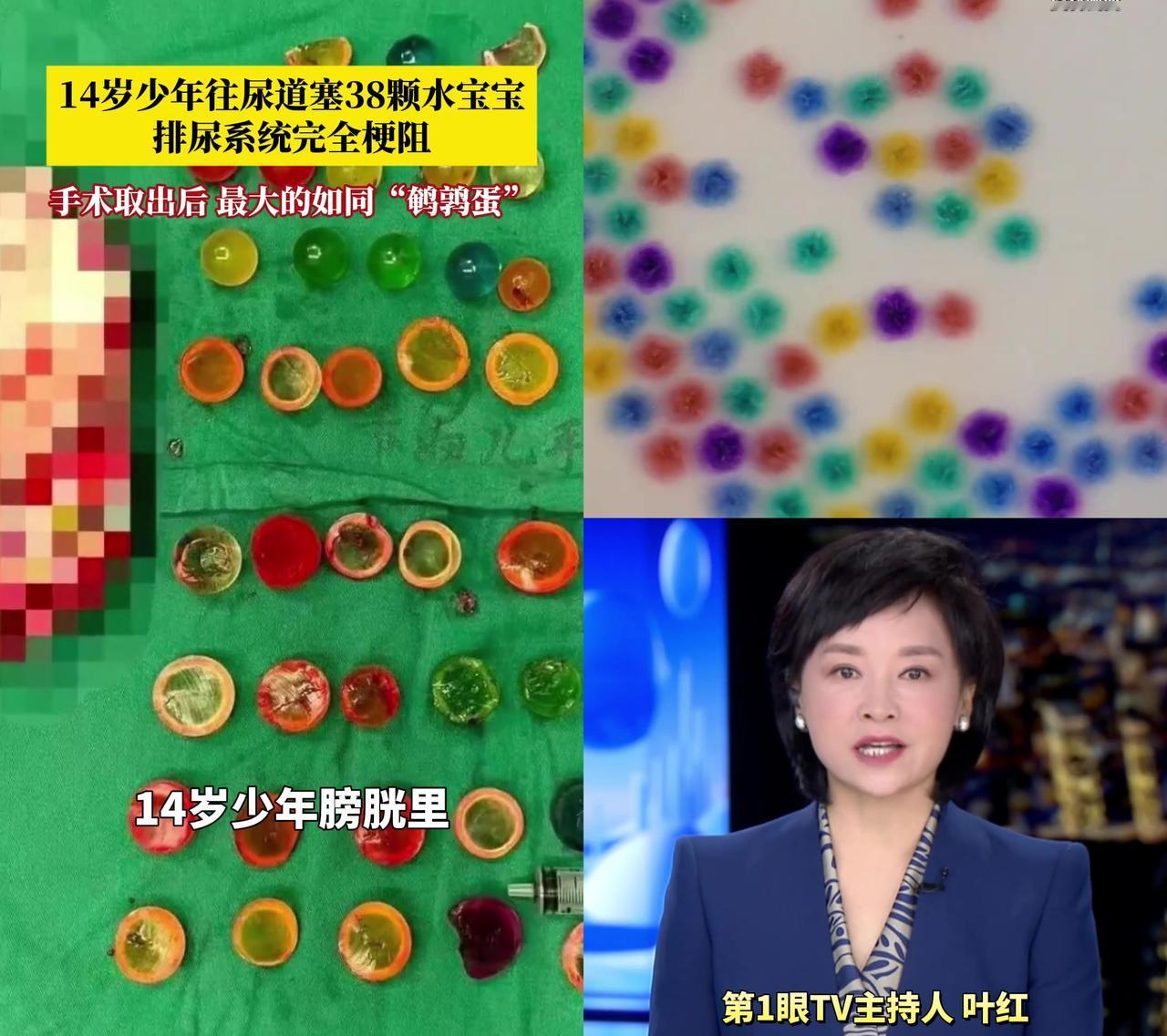 武汉14岁男孩被抬进手术室时，裤裆里的38颗小颗粒差点要了他的命！塞的时