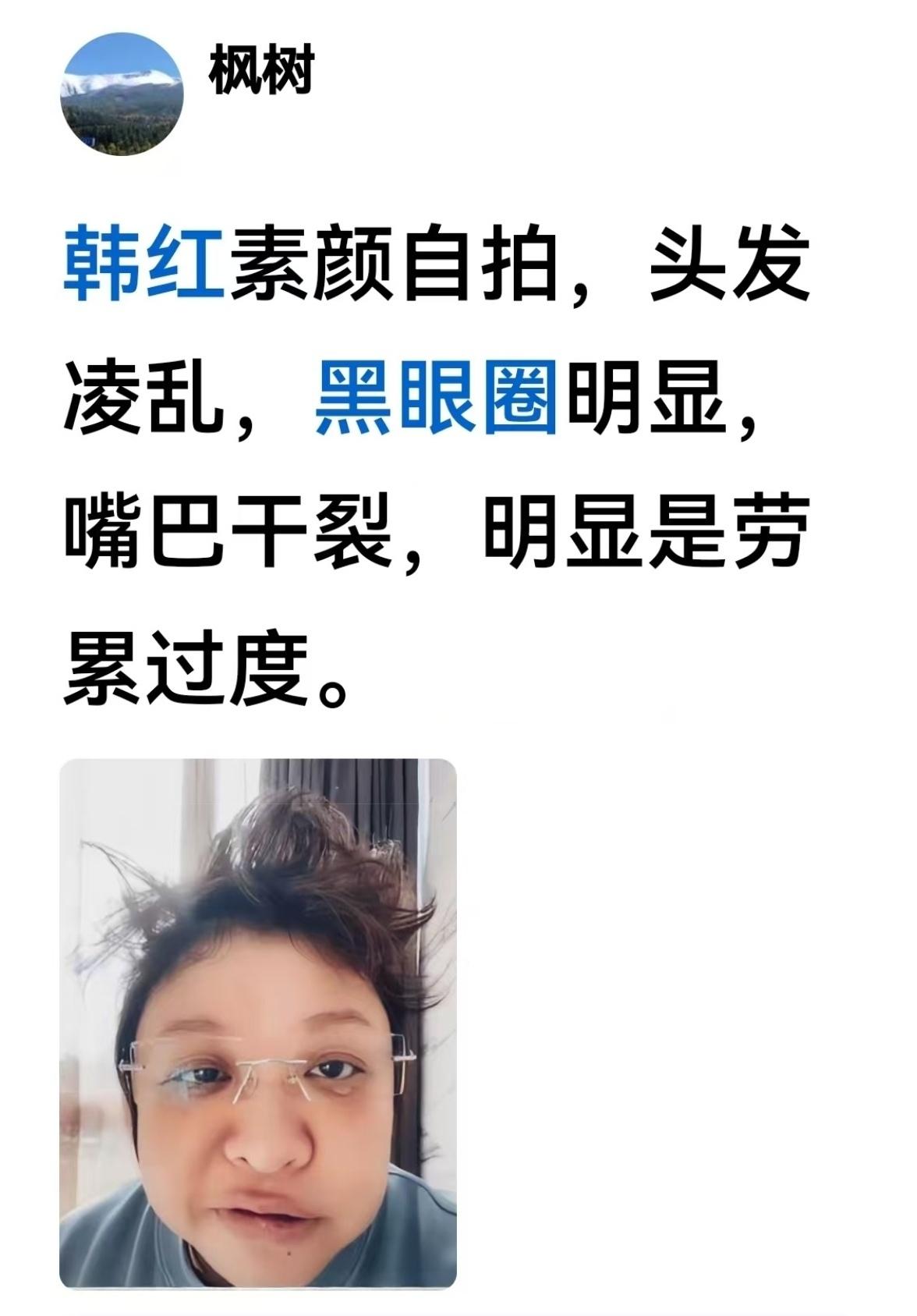 韩红太累了，看看网友发的吧。