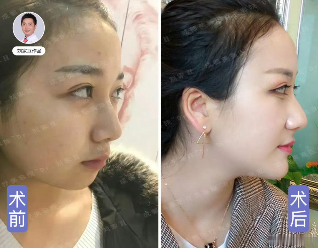 你不需要变得比别人好看多少，你只需要比以前的自己更好看就好了（p.s:谁说一定要