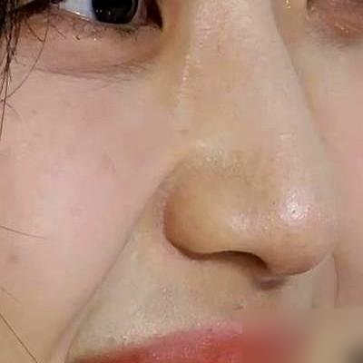 导演让她做烤瓷牙，孙千直接拒了。理由是，她觉得自己微黄的“原生牙”更真实。结果《早春晴朗》一播，热度