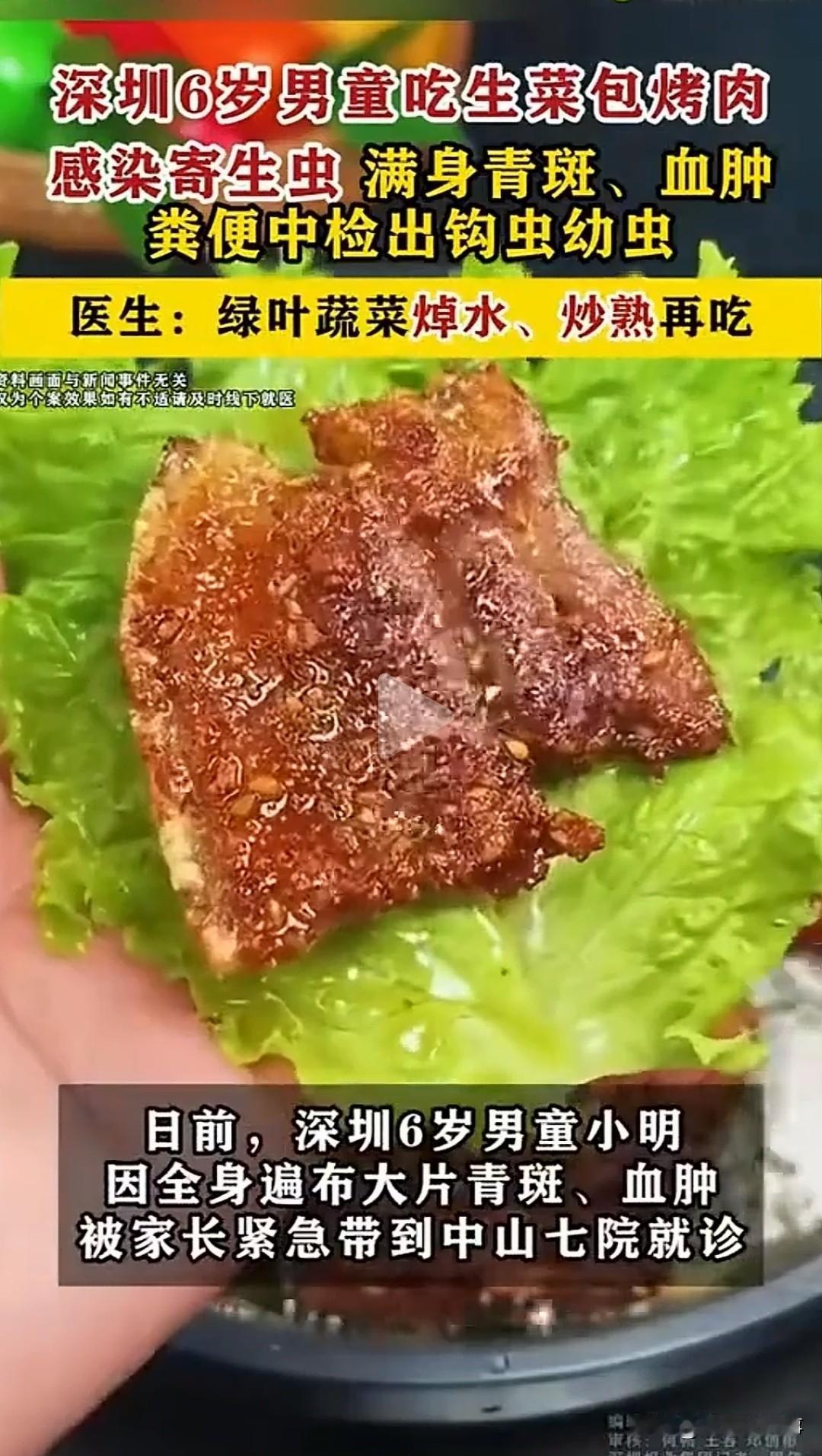 很多人觉得生菜生吃最健康？6岁男童只吃了几口生菜包烤肉，没想到一周后全身长满