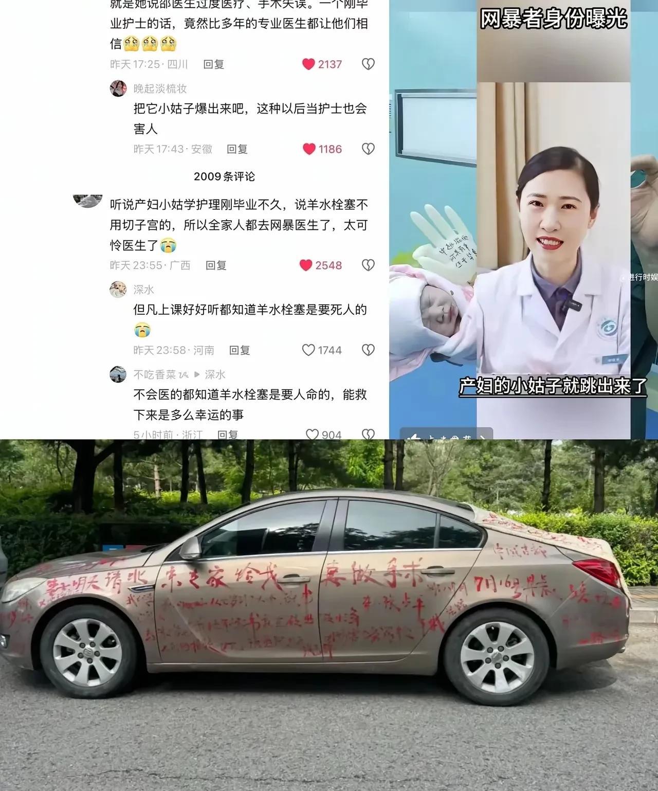 网暴绍医生的产妇家属小姑子，凭空捏造医生“手术失误”，被网友发现，她当时根本就不