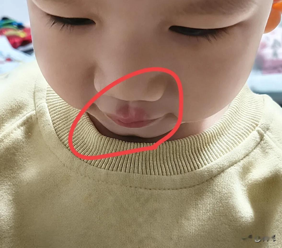 我最怕老师“告状”了尤其是2岁儿子还调皮捣蛋，爱咬人没想到昨个被“告状”了，