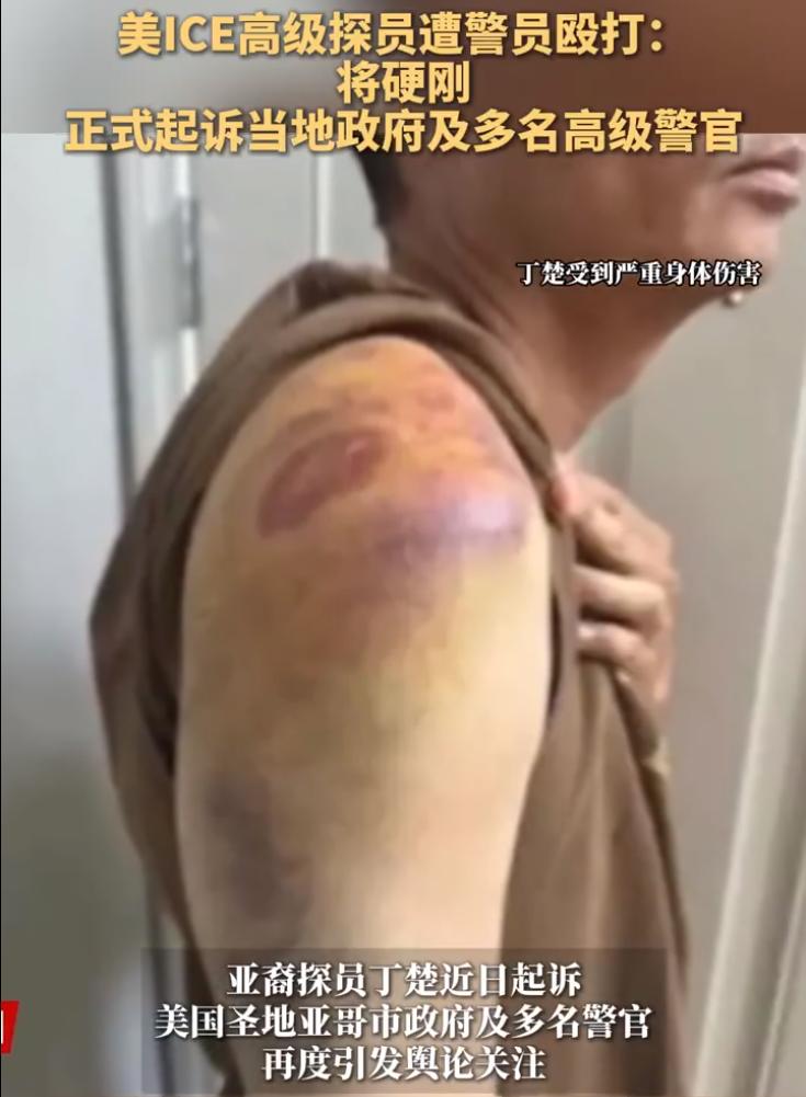 一个联邦探员，一个专门抓罪犯的执法人员，在超市门口被人打晕在地，结果警察来了之后