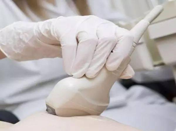 不同时期的孕期超声检查都在检查什么? 看看你都知道哪些?