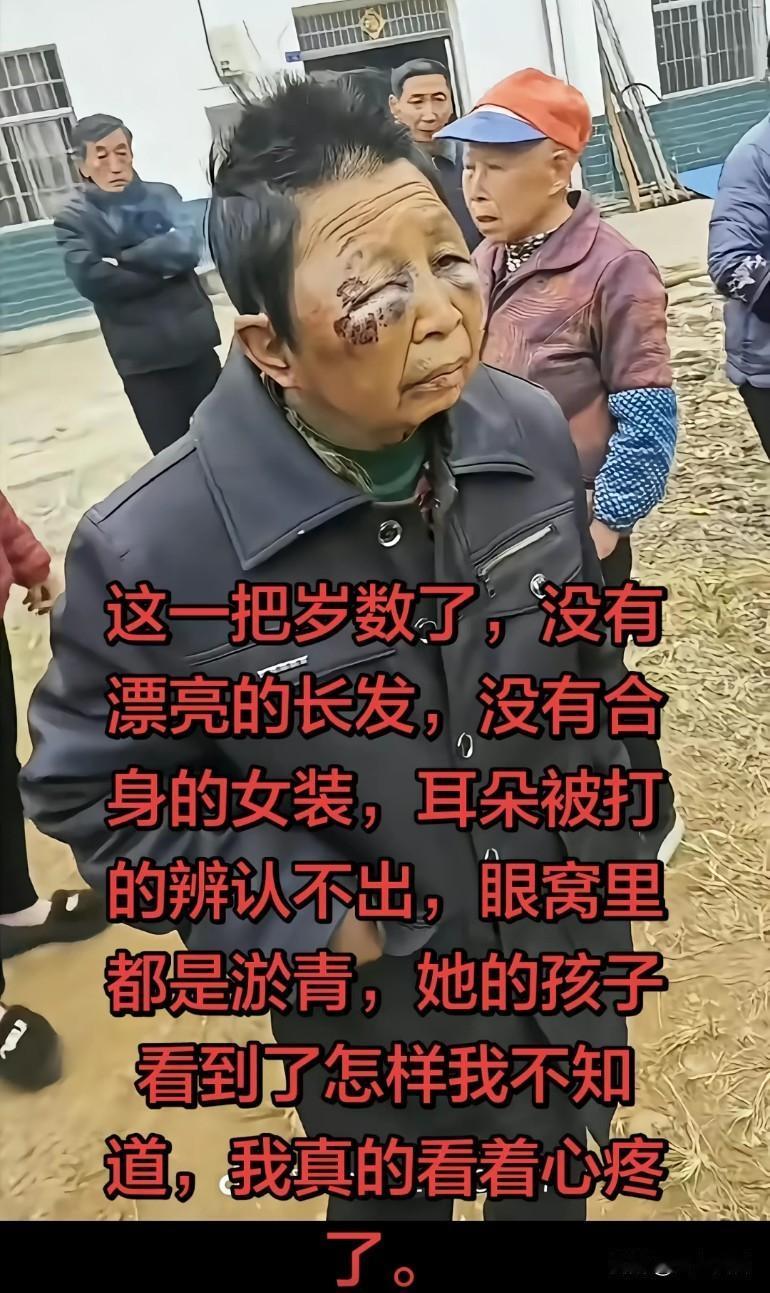 这一把岁数了，没有漂亮的长发，没有合身的女装，耳朵被打的辨认不出，眼窝里都是淤青