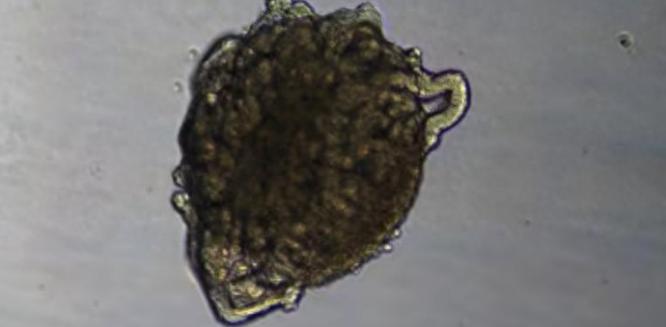 改变历史？未来大型疾病有望彻底绝迹！人类寿命或将无限被延长！这听起来