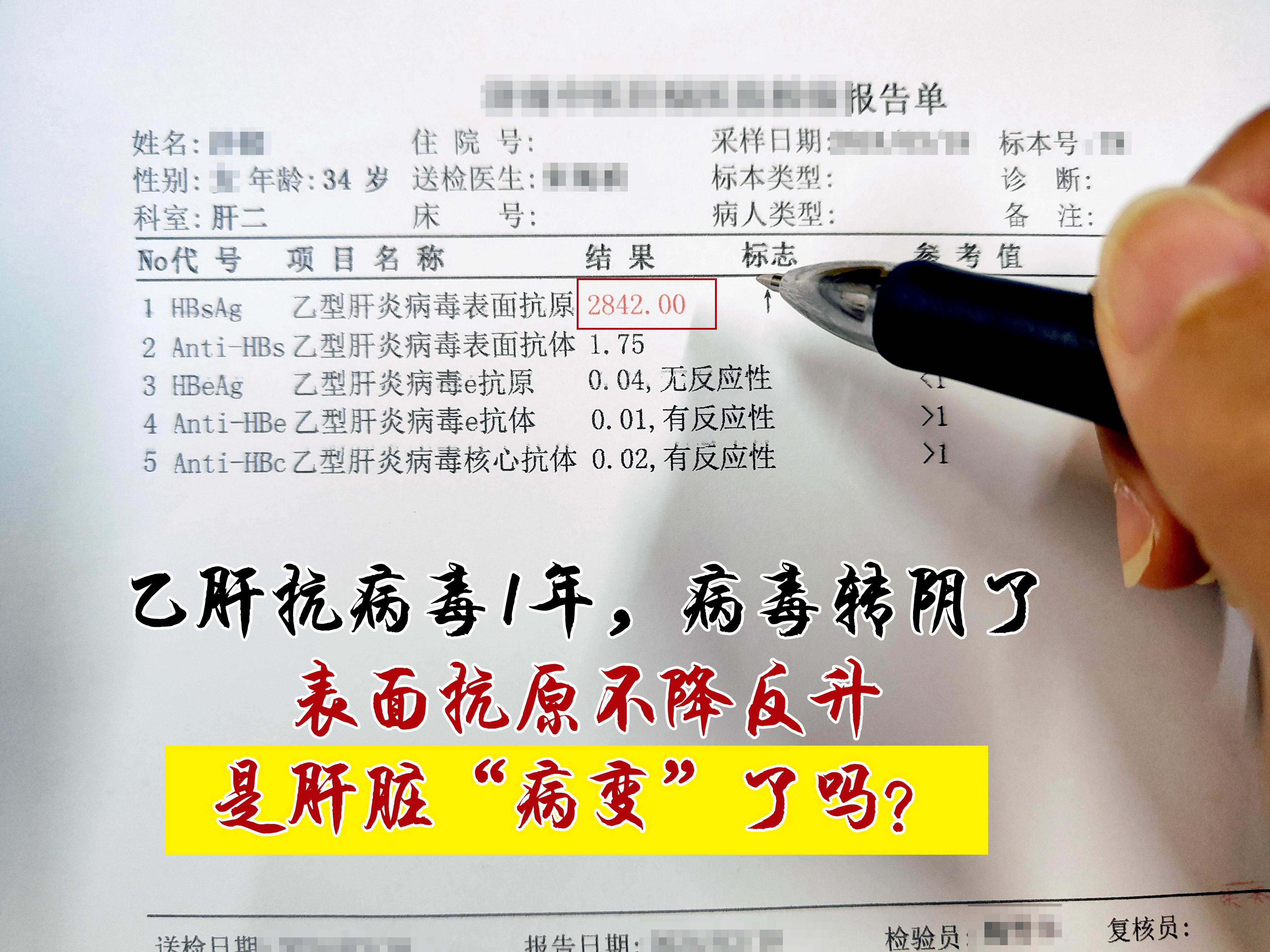 34岁的李先生确诊慢性乙肝后，坚持服用恩替卡韦抗病毒治疗1年，近期复查...