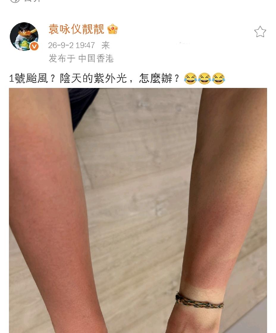 袁咏仪，发文求助！9月2日晚上，袁咏仪发文求助，一张照片令人看着十分吃惊，照