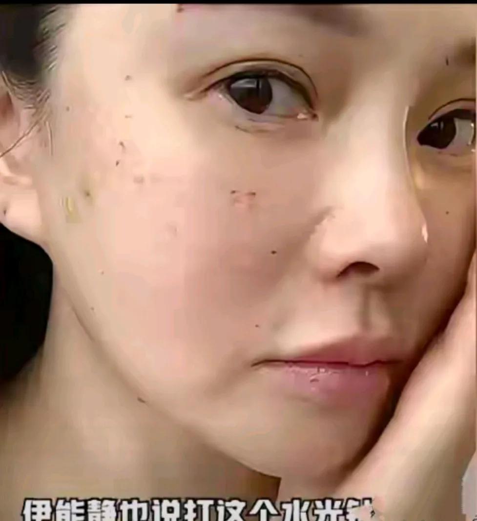 大方晒医美照她算很真实了曾经也说过自己每年花在医美上7位数满脸针孔给