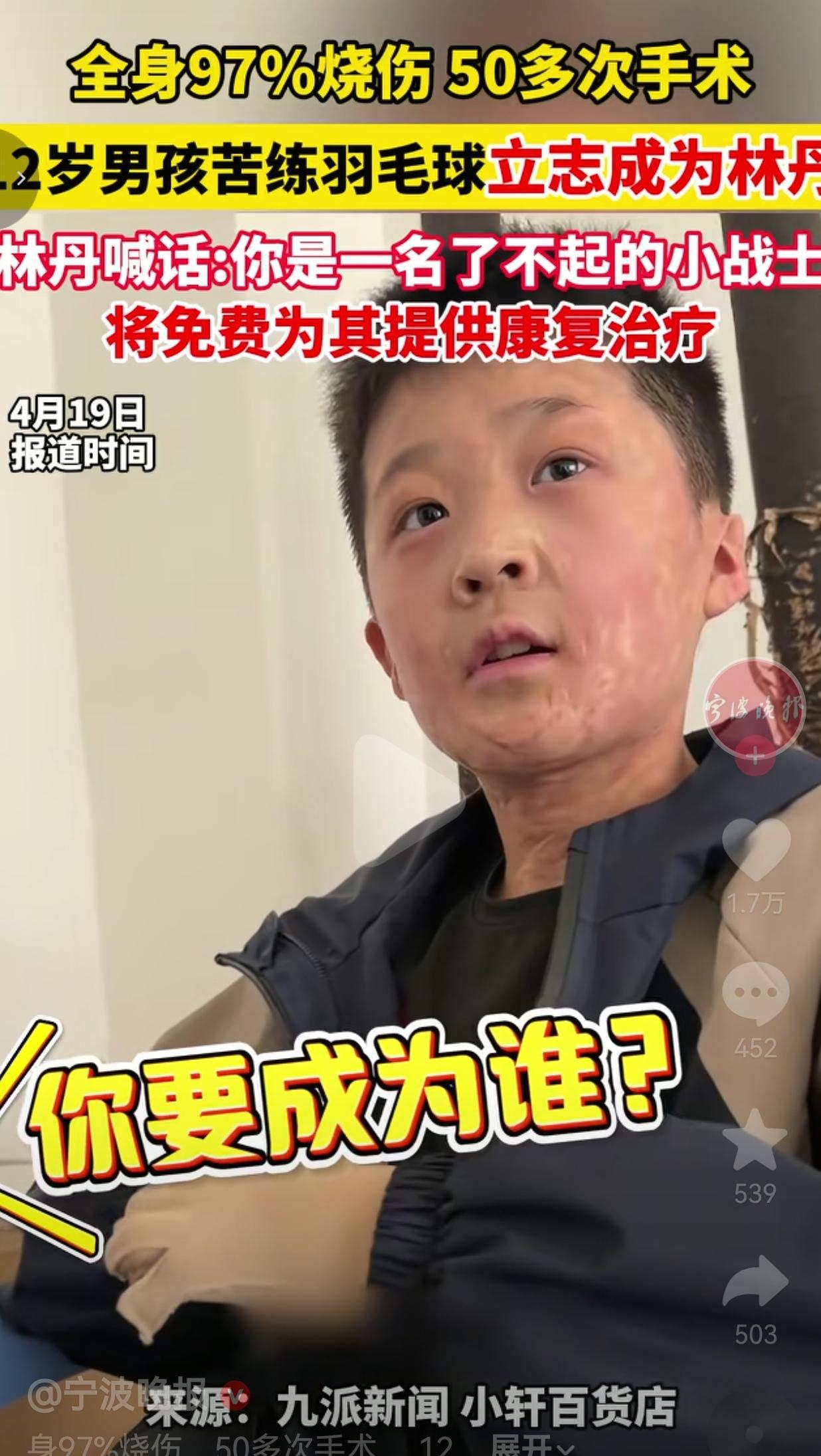 被大火烧了97%的12岁男孩，他说要成为林丹，林丹真的回应了全身97%烧伤