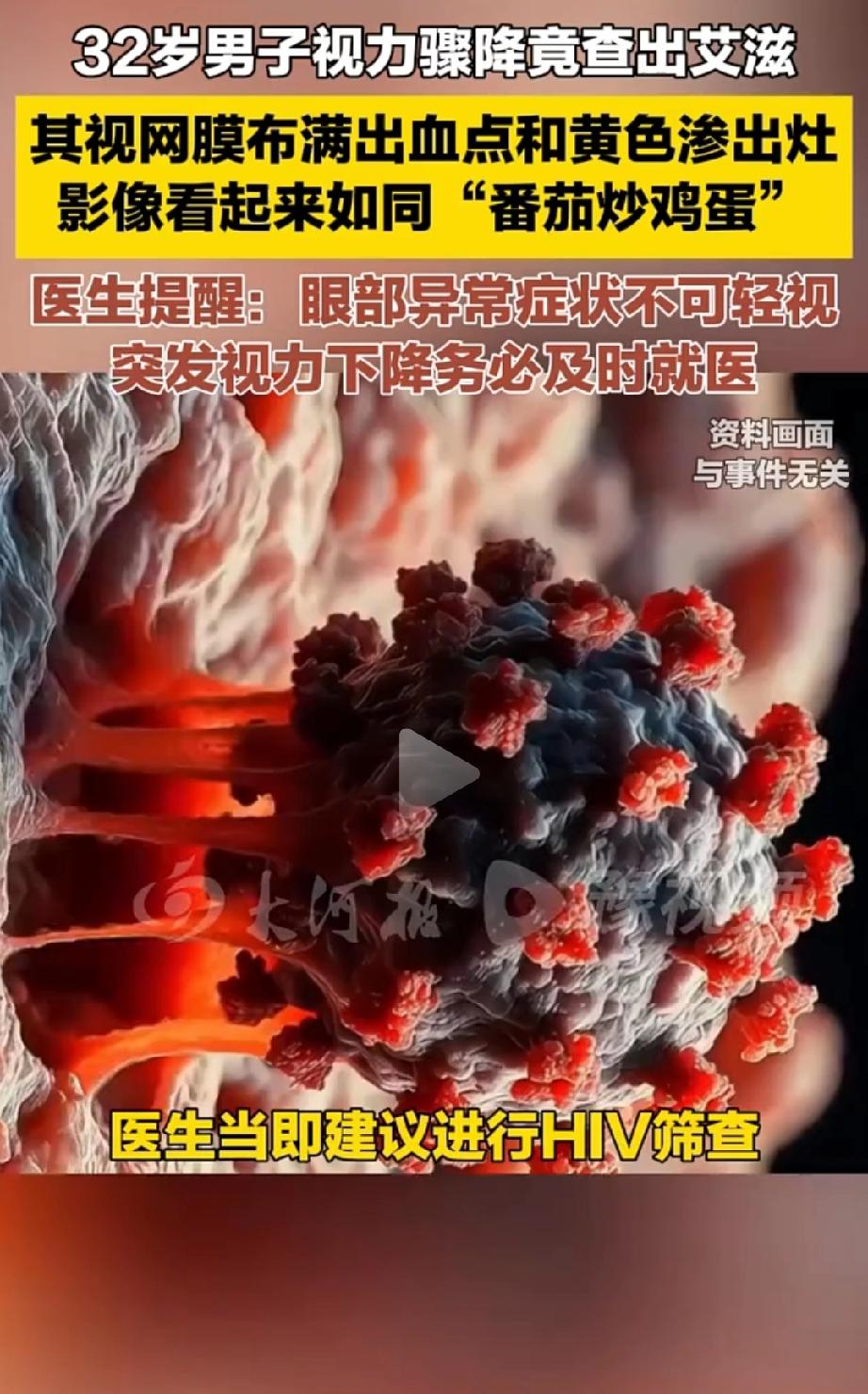 吓出冷汗！广东深圳，32岁的张先生，右眼出现“飞蚊”、视物模糊，本以为是熬夜导致