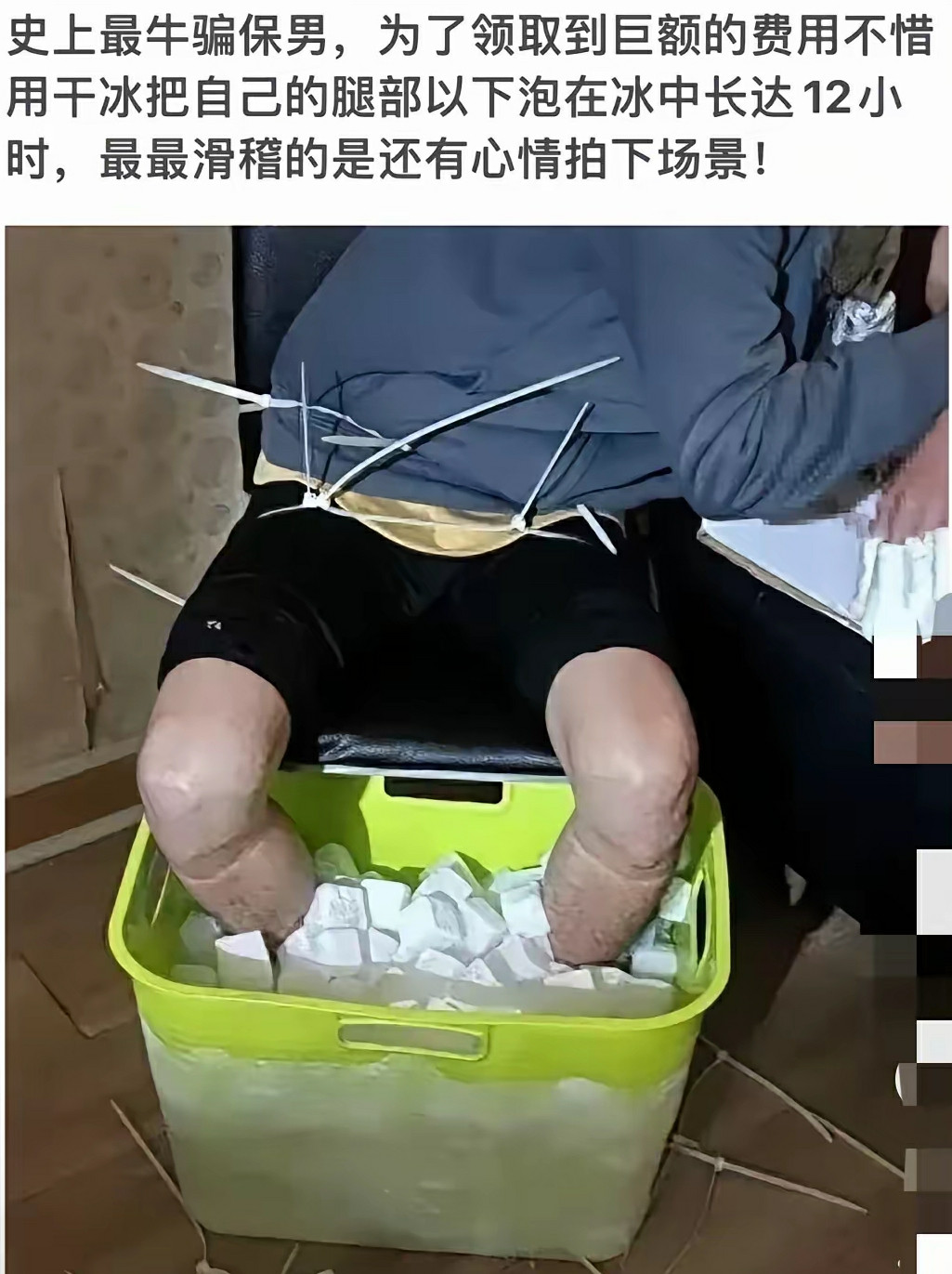史上最牛骗保男，用干冰泡腿12小时！