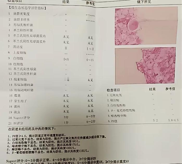 那年轻人尿路感染也是免疫力低下吗？我年轻的时候经常尿路感染，整天洗，吃药，也