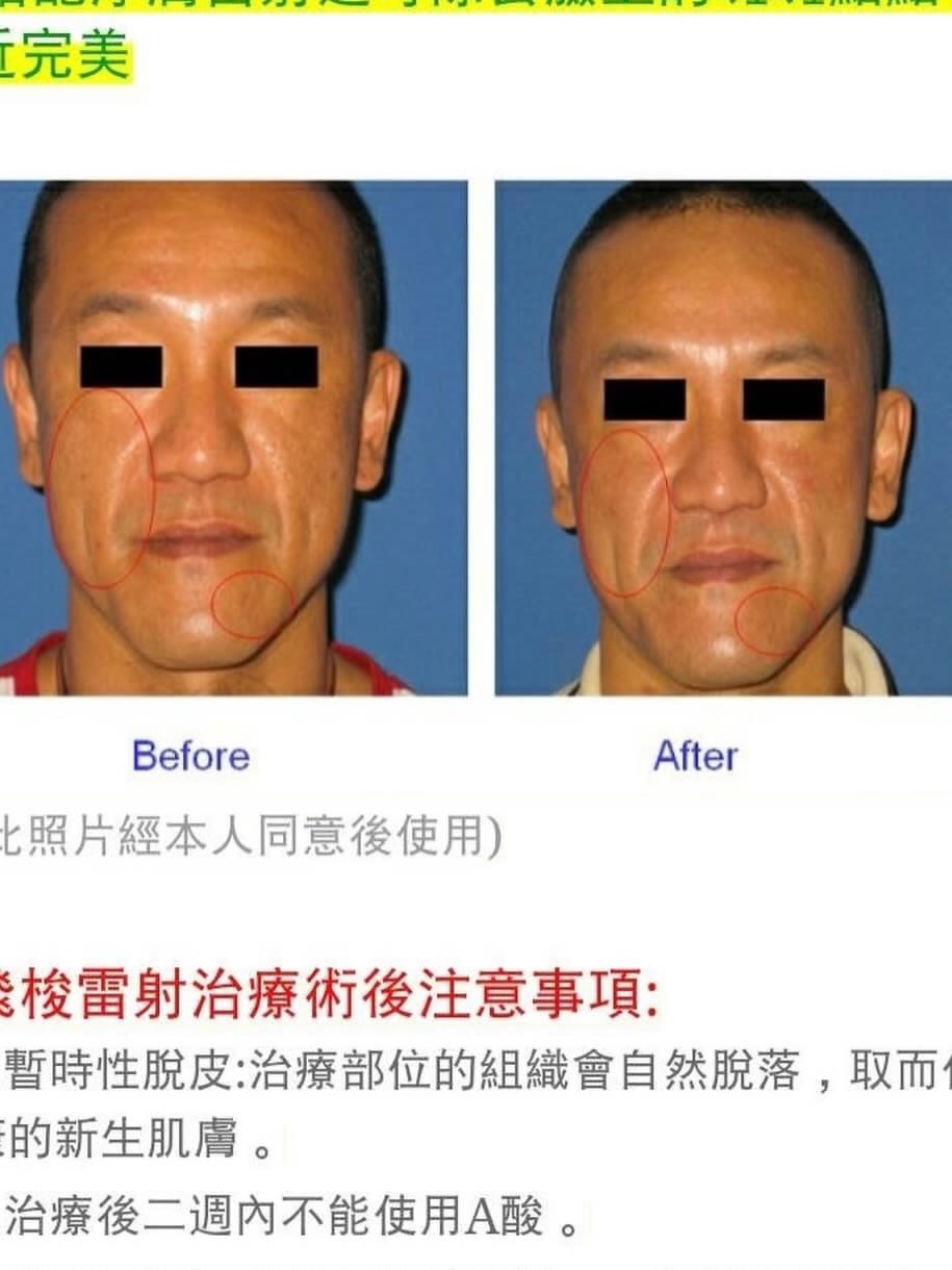 笑…好像没有马赛克的必要