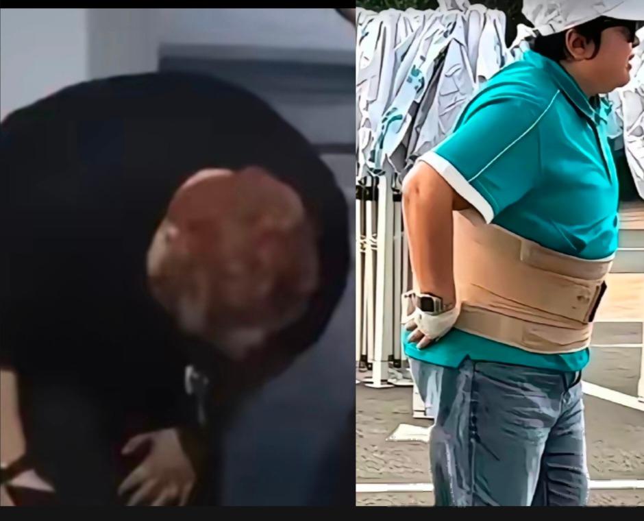 韩红这次被质疑，最麻烦的不是腰到底有没有伤。而是前后两个画面放在一起，观感太别扭