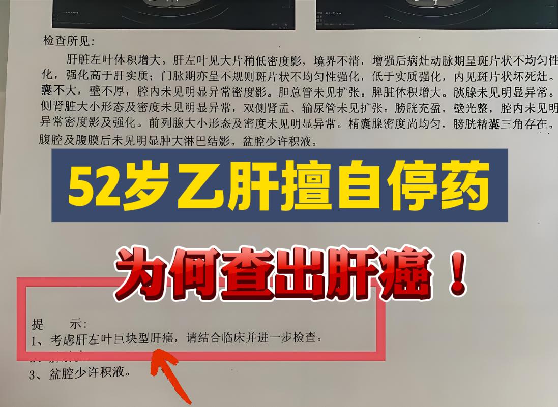 52岁乙肝擅自停药为何查出肝癌! 在临床中，乙肝患者因擅自停药导致出现...