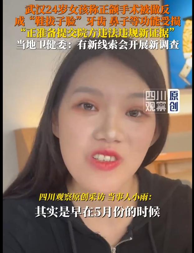 武汉女孩正颌手术被做反致成“鞋拔子”脸，最新进展！2025年，武汉24岁模特小