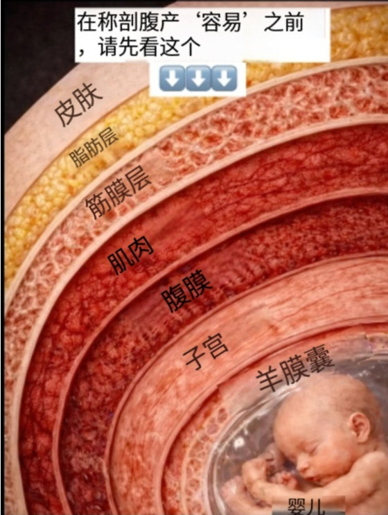 产后恢复剖腹产并没有大家想的那么“容易”👇🏻👇🏻
