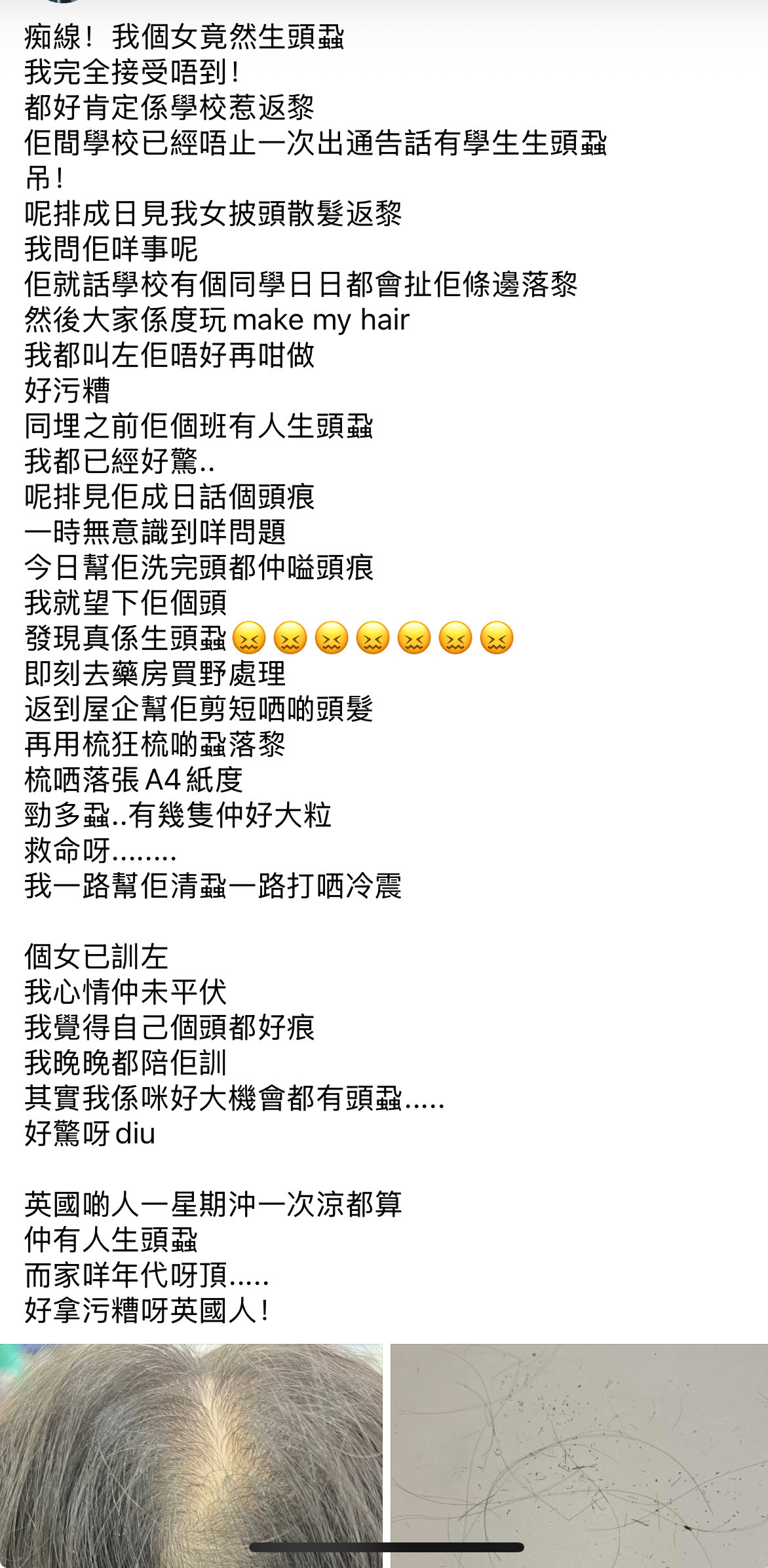 润英港人吐槽孩子有头虱，妈耶，看得我头皮发麻