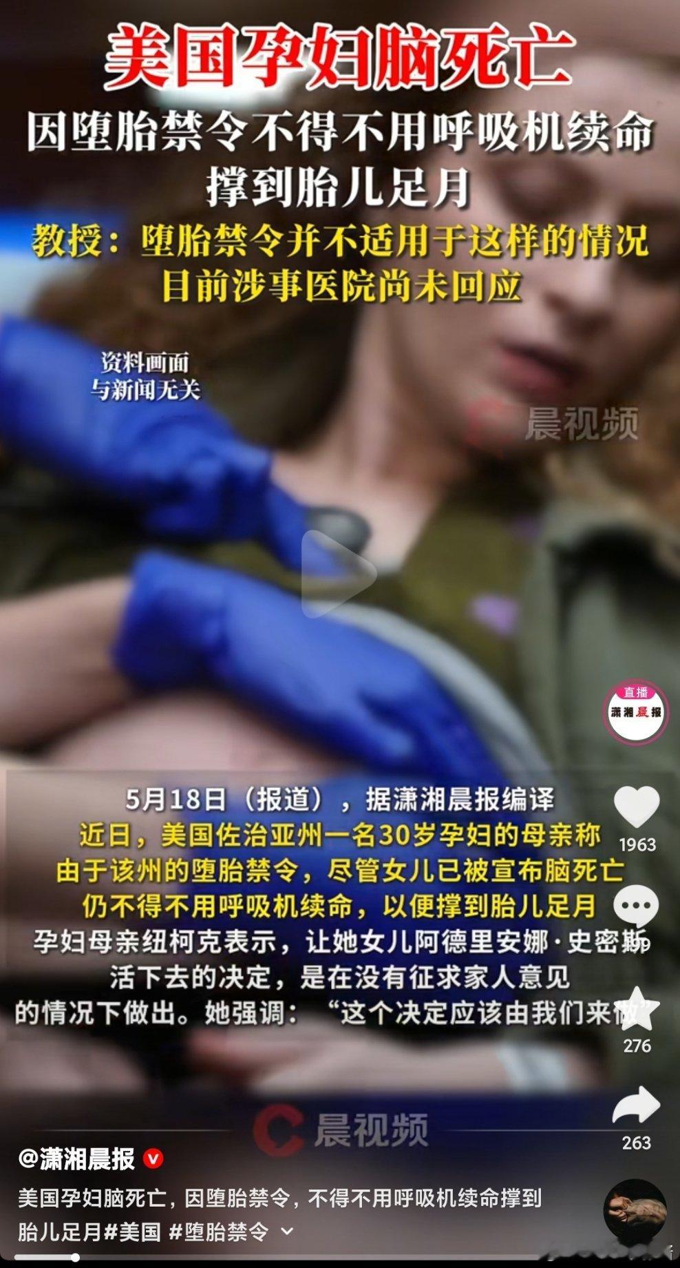 离谱​​​
