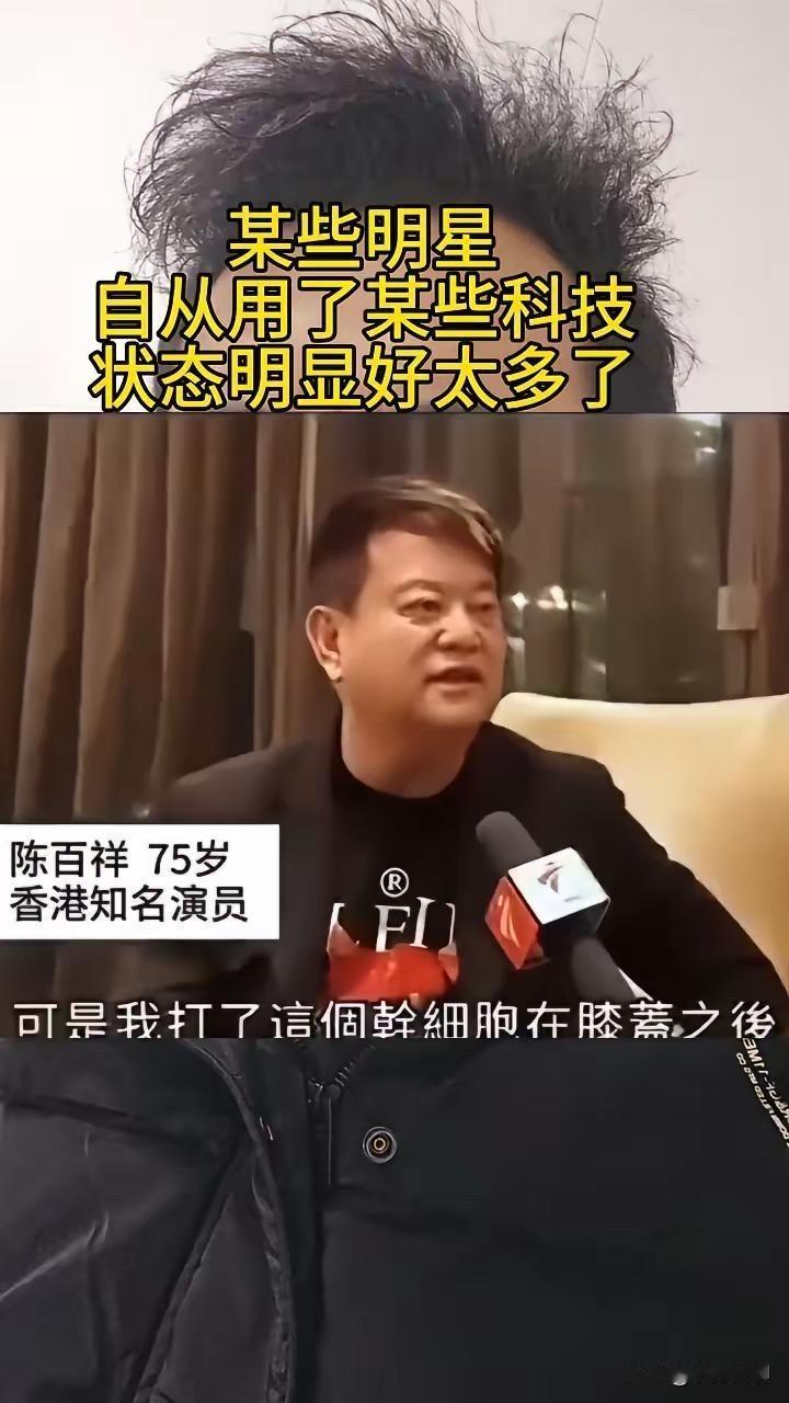 看了陈百祥的采访我才明白明星状态突然变好，肯定是用了科技陈百祥说，给膝盖注