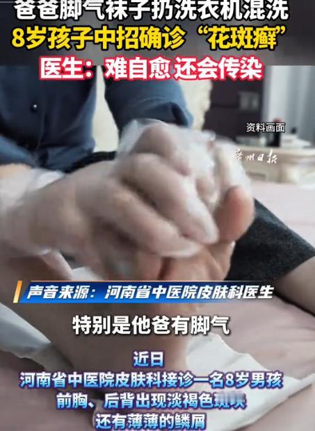 真出事了！8月18日齐鲁壹点报道，河南，一8岁小孩前胸后背长满淡褐色小斑片，表面